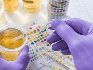 Stay Ahead of the Game: How Synthetic Urine Kits Can Help You Ace Drug Tests