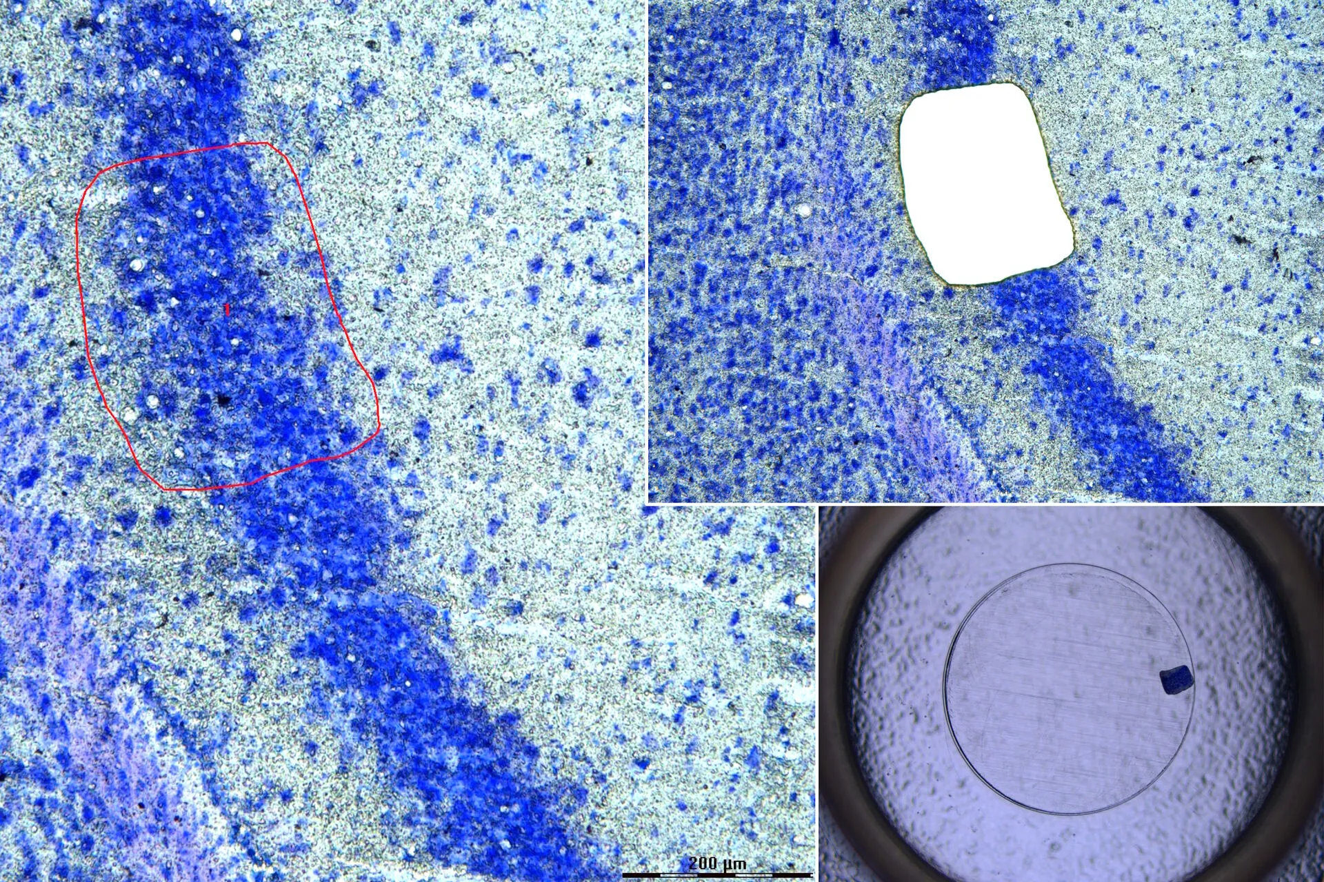 laser capture microdissection protocols